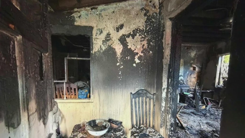 Woman hospitalized after Miami house fire leaves three displaced — CBS Miami, Richardson Health news